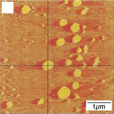 Nanobubbles Form at Active Hydrophobic Spots on the Luminal Aspect of Blood Vessels: Consequences for Decompression Illness in Diving and Possible Implications for Autoimmune Disease—An Overview